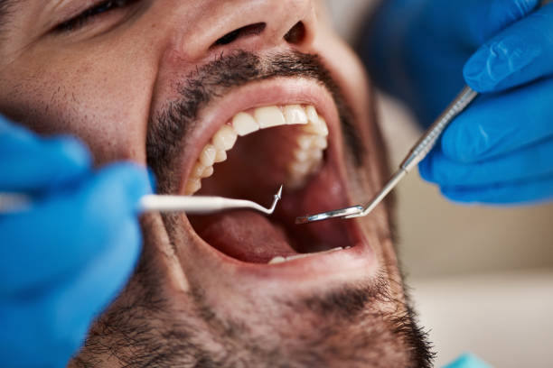 Best Dentist Open Late Near Me  in Queens Gate, PA
